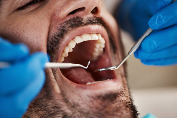 Best Preventive Dentistry  in Calhoun City, MS
